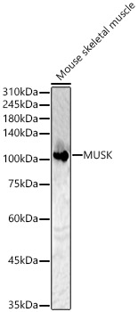 MUSK Polyclonal Antibody