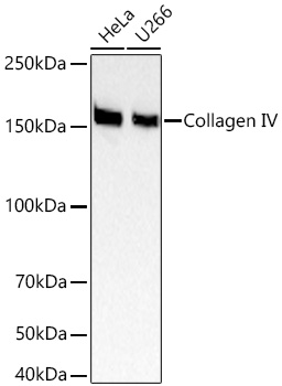 Collagen IV Monoclonal Antibody