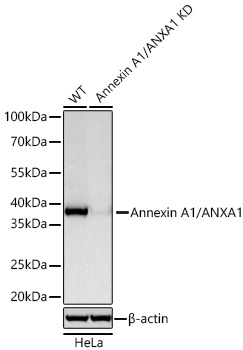 Annexin A1/ANXA1 Monoclonal Antibody [2K10E5]
