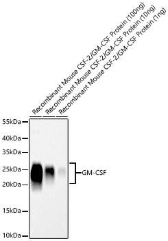GM-CSF Monoclonal Antibody [9H9Z7]