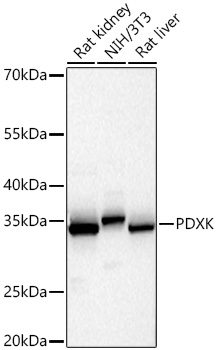 PDXK Monoclonal Antibody [10W7O7]
