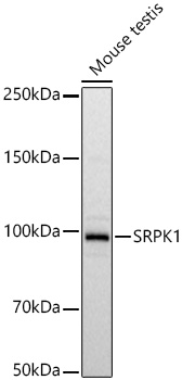 SRPK1 Monoclonal Antibody [7U8H8]
