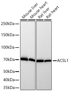 ACSL1 Monoclonal Antibody [2Y5F1]&nbsp;<img src="images/icon_newarrival.gif" alt="new" border="0">
