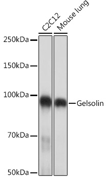Gelsolin Monoclonal Antibody [5O10O1]