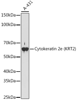 Cytokeratin 2e (KRT2) Monoclonal Antibody [9T3Q2]