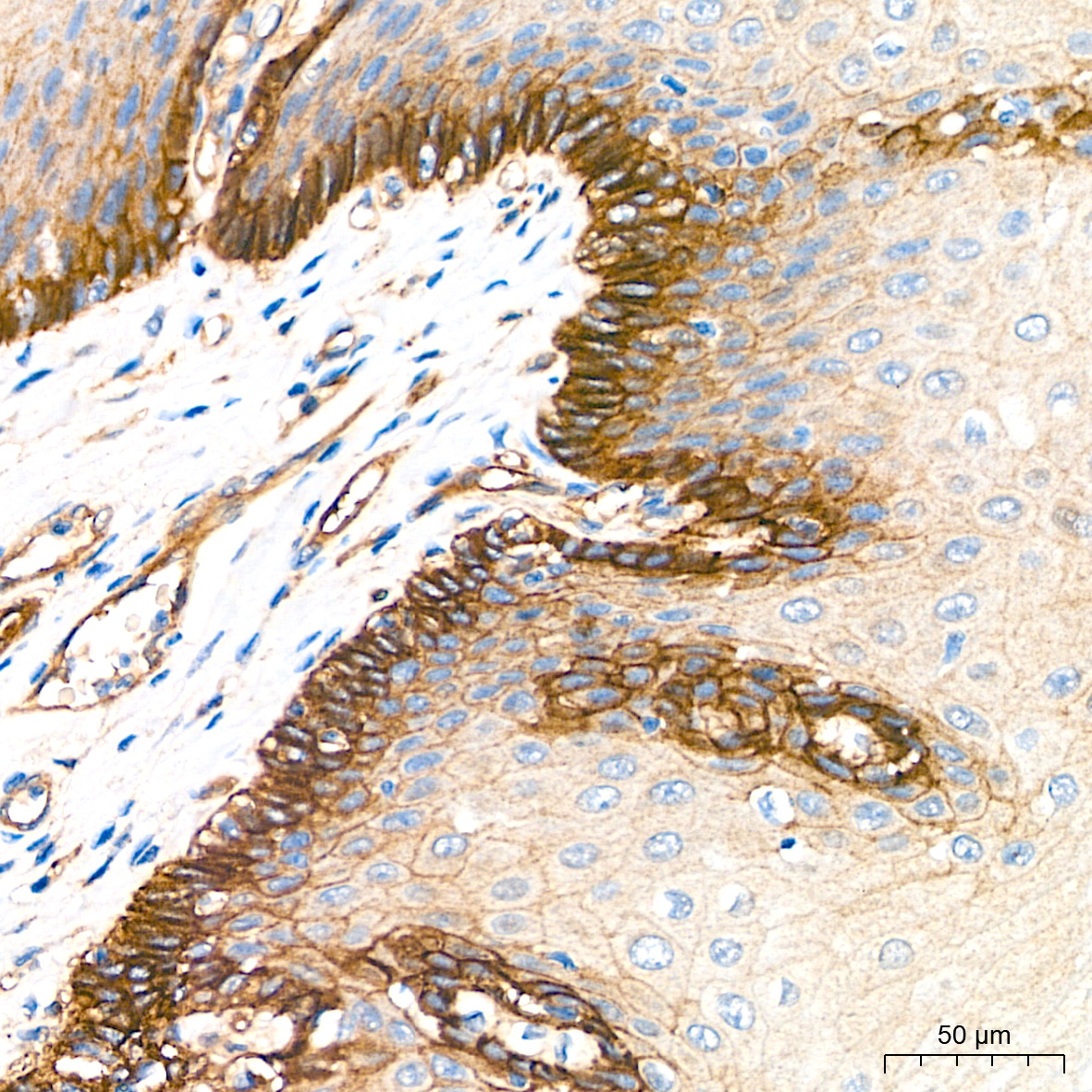 Integrin alpha 3/CD49c Monoclonal Antibody [10G10G7]