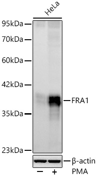 FRA1 Monoclonal Antibody [8M3Q2]