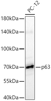 p63 Monoclonal Antibody