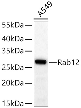 Rab12 Monoclonal Antibody [MJFF-A-6E6] [2R5P3]