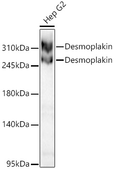 Desmoplakin Monoclonal Antibody [3O5O3]
