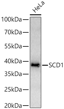 SCD1 Monoclonal Antibody [2L7J4]