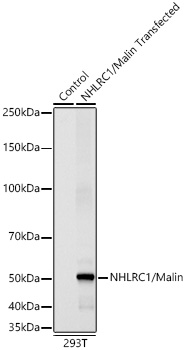 NHLRC1/Malin Monoclonal Antibody [2I2J9]