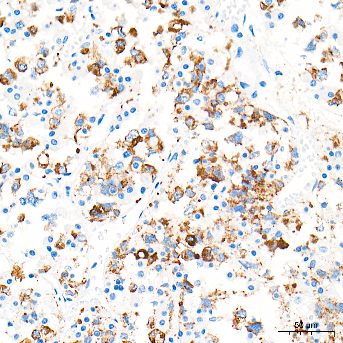 PRL/Prolactin Monoclonal Antibody [3P8U1]