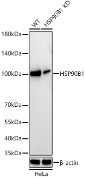 HSP90B1 Monoclonal Antibody [7P4V7]