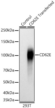 CD62E Monoclonal Antibody [8U1K1]
