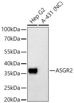 ASGR2 Monoclonal Antibody [4L5P8]