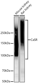 CaSR Monoclonal Antibody [6U10Q6]