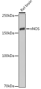nNOS Monoclonal Antibody [5K9R2]