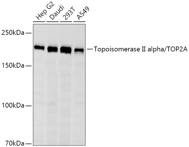 Topoisomerase II alpha/TOP2A Monoclonal Antibody [9R1B3]