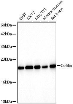 Cofilin Monoclonal Antibody [4M1Z9]