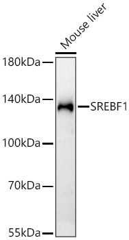 SREBF1 Monoclonal Antibody [6V9I8]