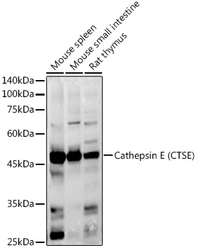 Cathepsin E (CTSE) Polyclonal Antibody