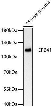 EPB41 Monoclonal Antibody [10F9S5]