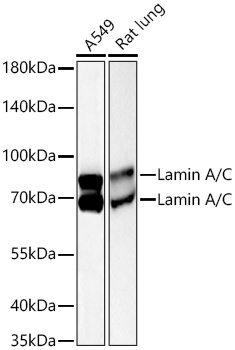 Lamin A/C Monoclonal Antibody [5T7H9]