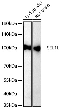 SEL1L Monoclonal Antibody [0U4J8]