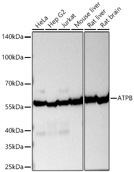 ATPB Monoclonal Antibody [1T10H5]