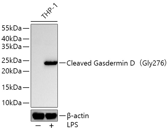 Cleaved Gasdermin D(Gly276) Monoclonal Antibody [5Y8S7]