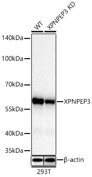 XPNPEP3 Monoclonal Antibody [10R9V2]