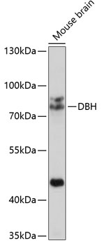 DBH Polyclonal Antibody