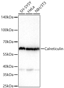 Calreticulin Monoclonal Antibody [10K4F3]