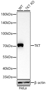 TKT/Transketolase Monoclonal Antibody [7P3J8]