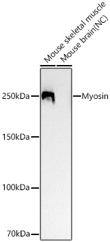 Fast Myosin Skeletal Heavy chain Monoclonal Antibody [5D7G8]