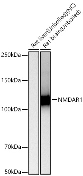 NMDAR1 Monoclonal Antibody [1B1C8]