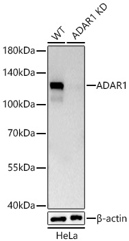 ADAR1 Monoclonal Antibody [8T1W3]