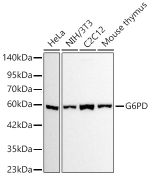 G6PD Monoclonal Antibody [9V8Y7]