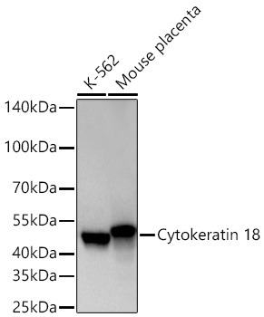 Cytokeratin 18 Monoclonal Antibody [4T0W8]