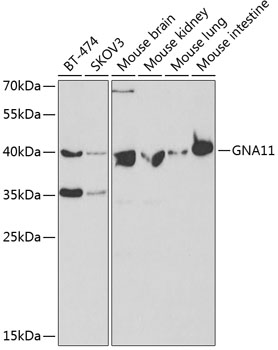 GNA11 Polyclonal Antibody