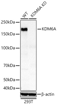 KDM6A Monoclonal Antibody [5I8O3]&nbsp;<img src="images/icon_newarrival.gif" alt="new" border="0">
