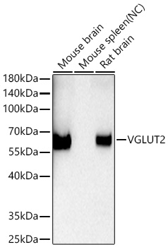 VGLUT2 Monoclonal Antibody [9H4K7]