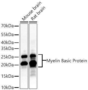 Myelin Basic Protein Monoclonal Antibody [2O7O6]