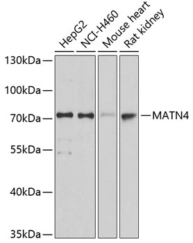 MATN4 Polyclonal Antibody