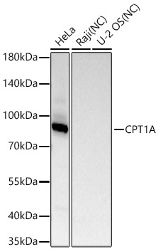 CPT1A Monoclonal Antibody