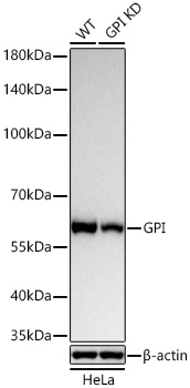 GPI Monoclonal Antibody [9U2V8]&nbsp;<img src="images/icon_newarrival.gif" alt="new" border="0">