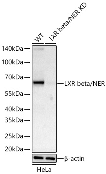 LXR beta/NER Monoclonal Antibody [3Z9W5]&nbsp;<img src="images/icon_newarrival.gif" alt="new" border="0">
