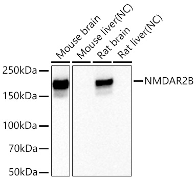 NMDAR2B Monoclonal Antibody [3I9F6]