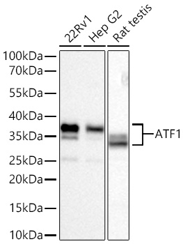 ATF1 Monoclonal Antibody [3P6H7]